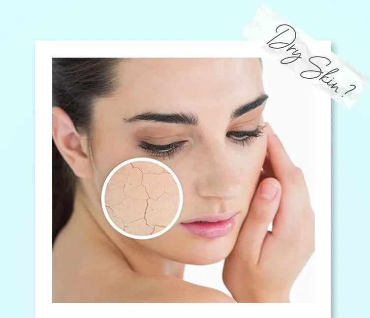 🌿 Dry Skin: Causes, Treatment & Herbal Remedies for Soft, Nourished Skin